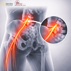 Sciatica and Nerve Pain at om Ayurveda