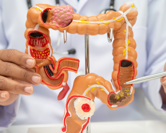 IBS Is a Gut-Brain Problem: Why Ayurveda Treats Both at the Same Time